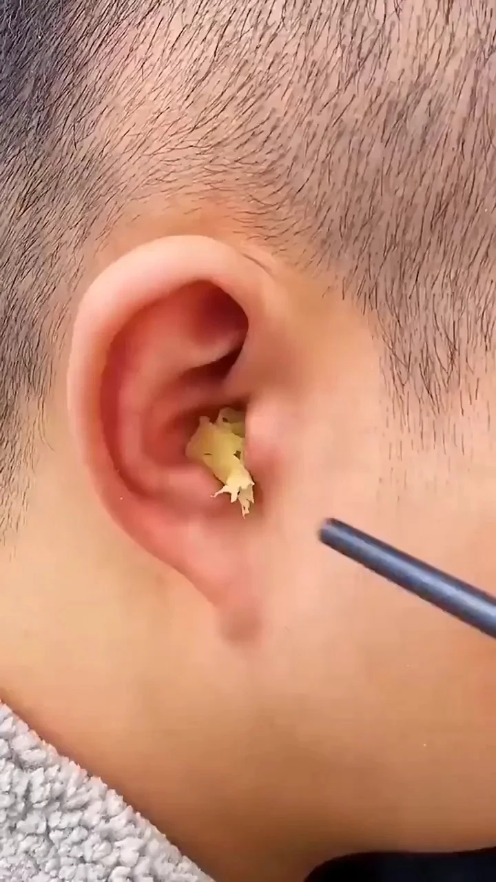 Ear Wax Removal Kit – 6 Pcs Multicolor Ear Cleaning Tool Set for Adults and Kids with Spring Ear Pick